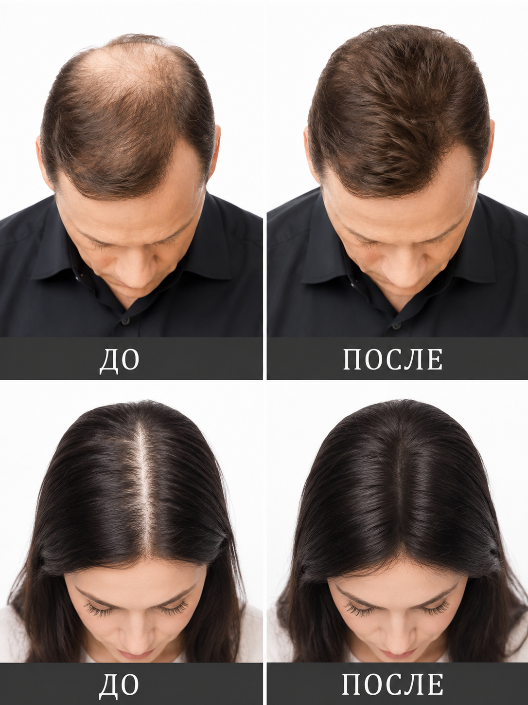 Загуститель волос Toppik фото до и после использования Загуститель волос Toppik фото до и после использования