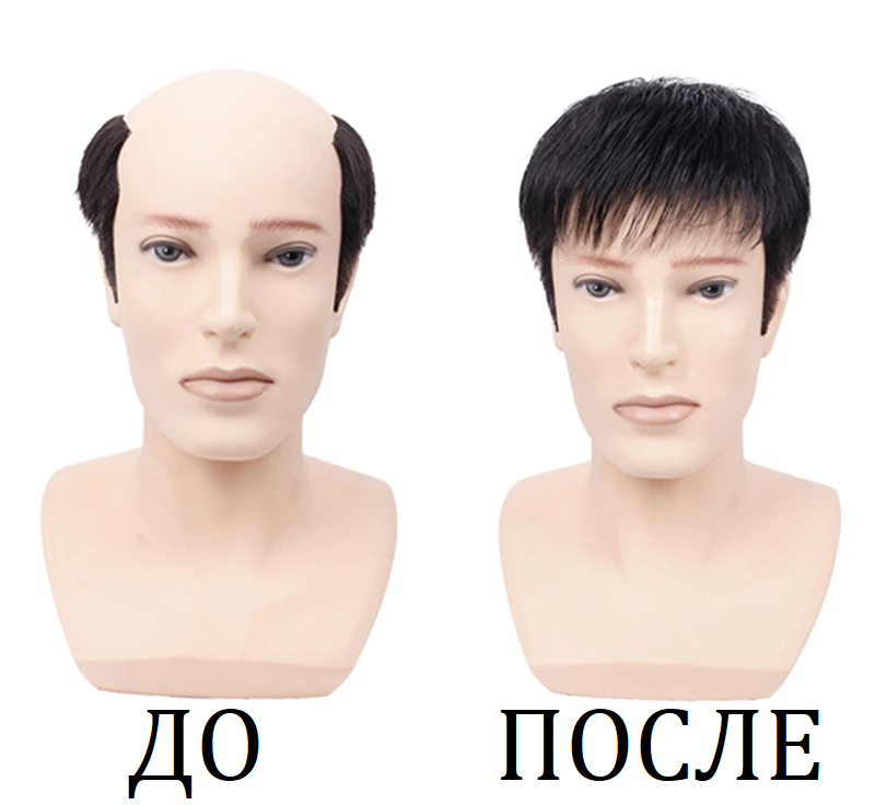 Накладка на макушку Halo
